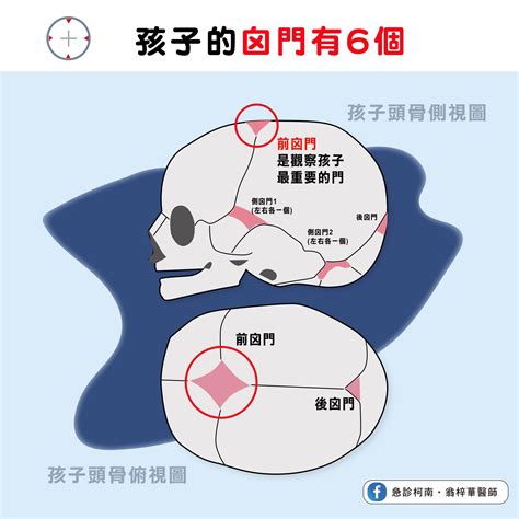 天靈蓋凹陷|囟門凹陷、突出代表什麼？了解囟門關閉時間、照顧方。